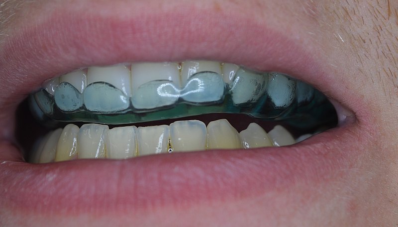 Level Orthodontics: Where Straight Teeth Meet Complete Wellness